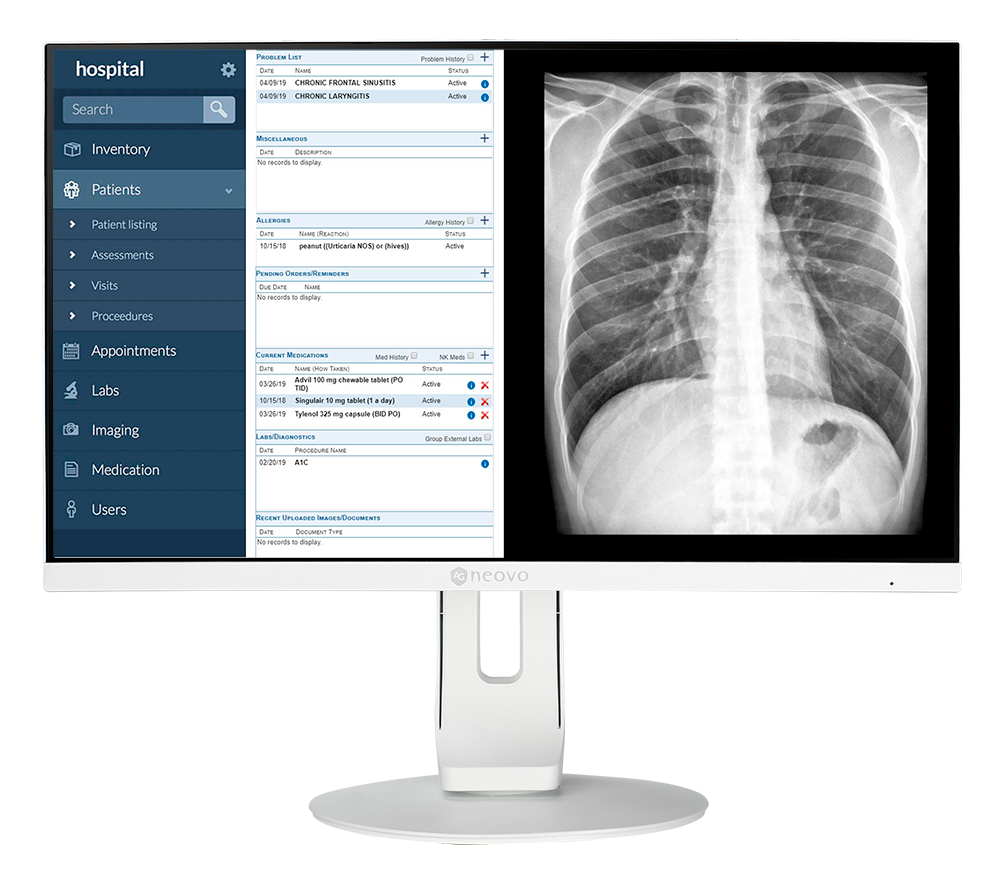 MD Series clinical review monitor