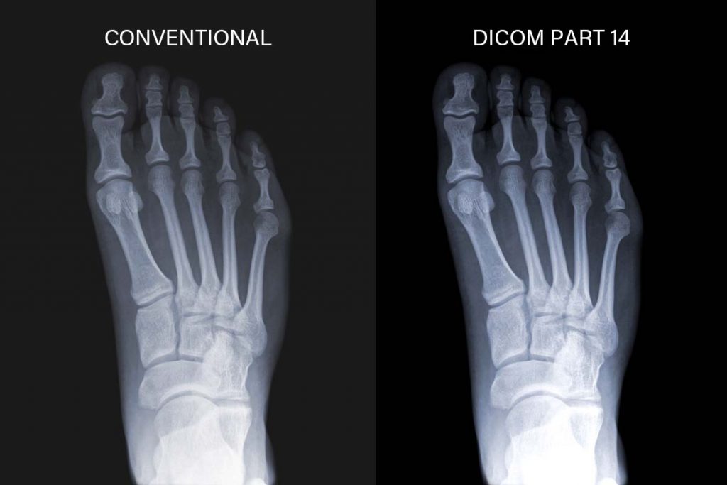 AG Neovo MX-24 dicom monitor is showing toes X ray image.