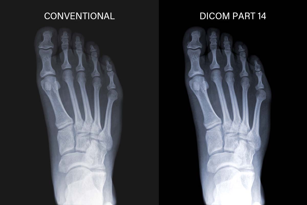 AG Neovo MX-24 dicom monitor is showing toes X ray image.