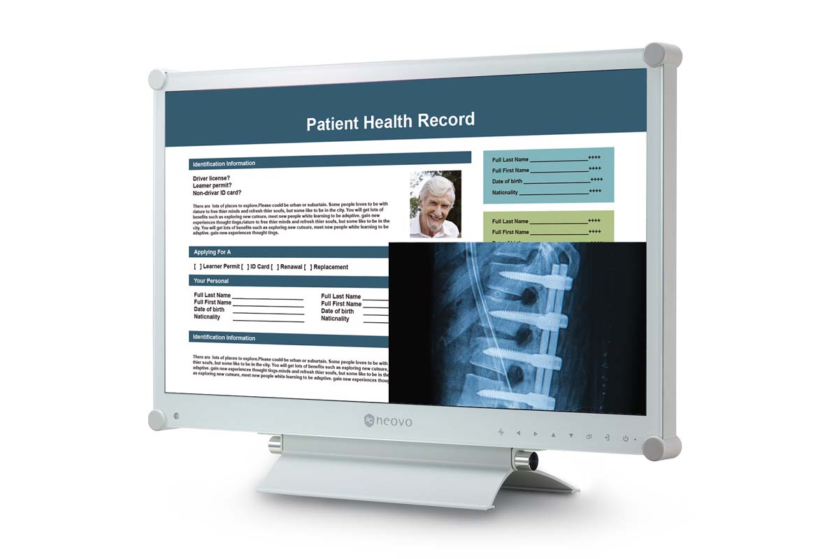 AG Neovo MX-22 22'' dicom monitor PIP, PBP functions