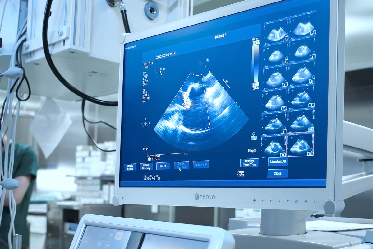 AG Neovo MX-24 24 dicom monitor can be mounted on medical cart