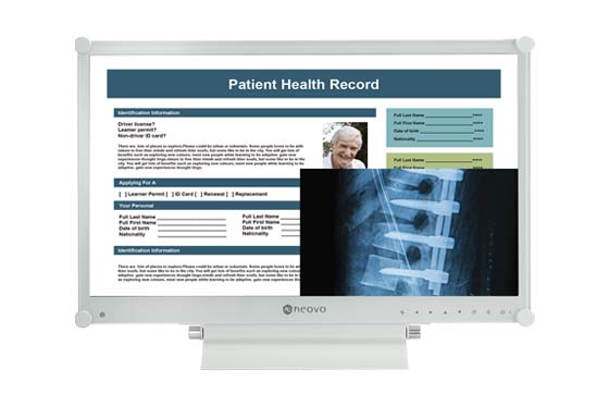 MX-Series DICOM monitor supports PiP and PbP for multitasking