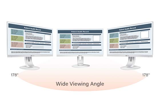 MD-Series clinical review monitors are wide viewing angle