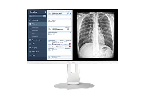 AG Neovo MD-2402 clinical review monitors feature 2MP Full HD 1080p resolution,