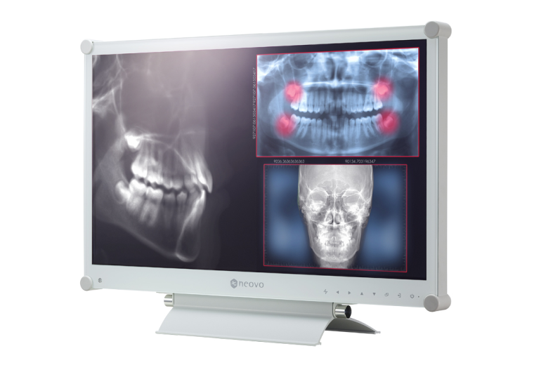 Medical screen displaying 2MP high-resolution image