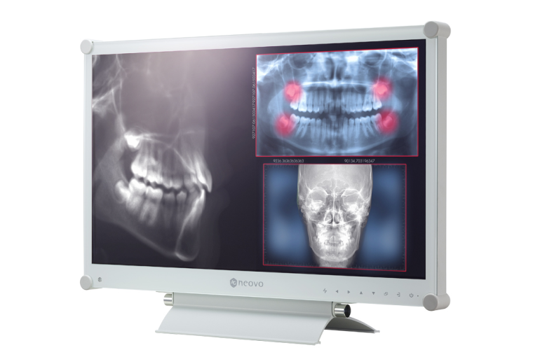 Medical screen displaying 2MP high-resolution image