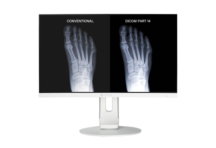 Medical LCD screen with DICOM Part 14 imaging mode