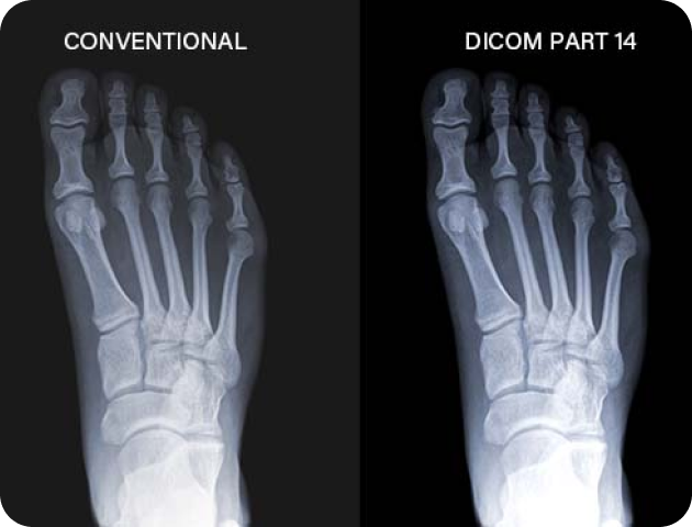 medical_monitors_DICOM_PART_14