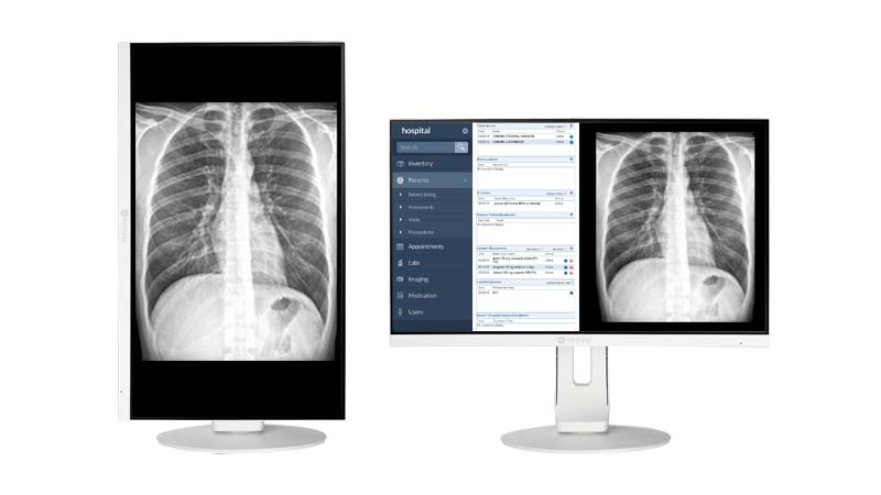 AG Neovo MD 系列醫療級螢幕直向與橫向顯示示意